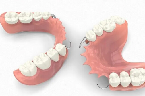 الأطقم المركبة (Dentures)