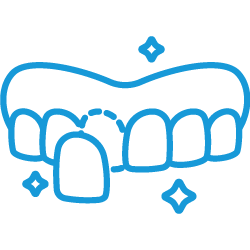 02 تركيب العدسات اللاصقة الرقيقة Veneers